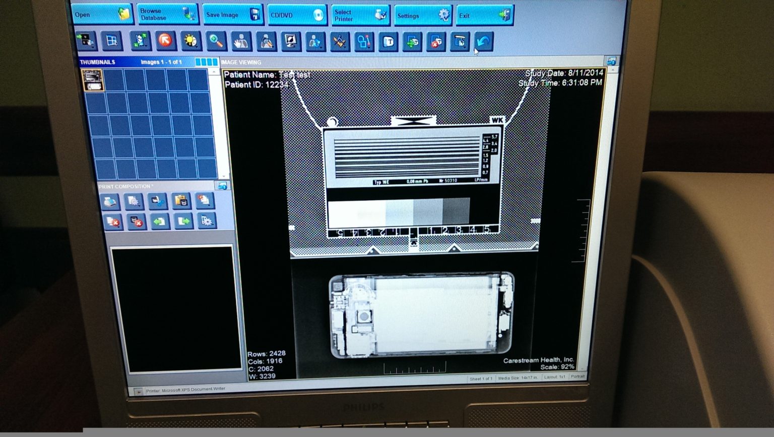 Kodak CR XRay Digital Processing System CR 140 MEDICAL TECHNOLOGY INC.